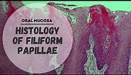 Histology of Specialized Mucosa | Filiform papillae