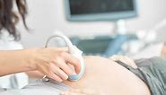 Are choroid plexus cysts dangerous on ultrasound?
