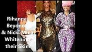 Nicki Minaj,Rihanna, & Beyonce Skin Whitening?