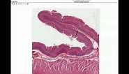 Anatomy | Histology of the Stomach & Small Intestine