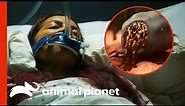 Tick Bite Infects Woman With Rare Parasites | Monsters Inside Me