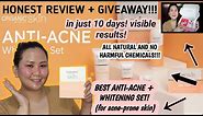 Organic Skin Japan Anti-Acne Whitening Set Honest Review