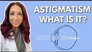 What Is Astigmatism? Eye Doctor Explains