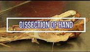Dissection Hand