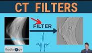 CT Filters (smooth filters and sharp filters, FBP Recon)