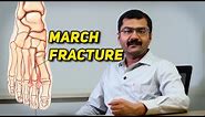 March Fracture Dr. Soundar