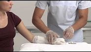 Plaster of Paris Dorsal Wrist Splint Application