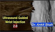Ultrasound Guided Wrist Injection in Rheumatoid Arthritis - Dr. Ankit Shah / MSK Ultrasound
