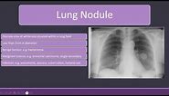 Lung Nodules and Bronchiectasis on Chest X-ray. #radiology