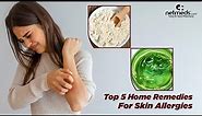 5 Best Natural Remedies For Skin Allergies