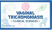 Vaginal trichomoniasis: Clinical sciences - Osmosis Video Library