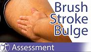 Brush / Stroke / Bulge / Swipe Test⎟Knee Swelling