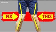 The Best Ways to Fix Knock Knees (AT HOME!)