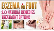 Eczema on Foot Treatment 10 Best Natural Home Remedies Treatment Options | Feet Dermatitis cure