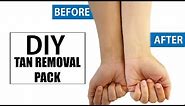 DIY: Natural Ways To Get Rid Of Sun Tanned Skin Instantly At Home | DIY Home Remedies