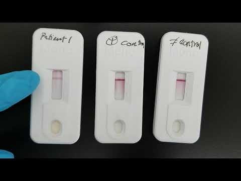 Immunology: Infectious Mononucleosis Test