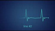 EKG Heart Monitor Flatline After Effects Templates