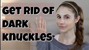 GET RID OF DARK KNUCKLES| DR DRAY