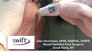 Swift Verrucae Treatment with Dr. Hochstein