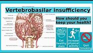 vertebrobasilar insufficiency