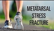 Metatarsal stress fracture: Mechanism of injury, signs, and treatment