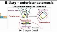 Roux-en-Y hepaticojejunostomy - anatomical basis and steps of surgery - Biliary-enteric anastomosis