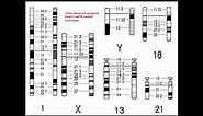 Cytogenetics II Chromosome Analysis & Karyotypes