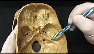 Skull Osteology - Cranial Cavity Anatomy