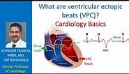 What are ventricular ectopic beats (VPC)? Cardiology Basics