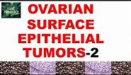 OVARIAN TUMORS - Part 3 : ENDOMETRIOID, CLEAR CELL & BRENNER TUMOR- Pathology