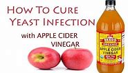 Apple Cider Vinegar for Yeast Infection Natural Treatment - yeast infection - home remedies