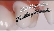 Tooth Preparation for PFM 🔵 Maxillary First Premolar 🟡 Step by Step Demonstration