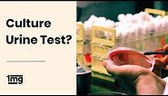What is Urine Culture Test? | 1mg