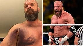 Triple H reveals brutal injury suffered in Saudi Arabia