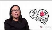 Signs and Symptoms of a Brain Tumor | Dana-Farber Cancer Institute