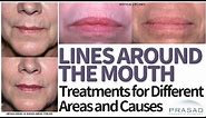 How to Treat Lines, Folds, and Wrinkles Around the Mouth and Lips