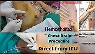 Chest Drain Procedure Direct From ICU||Live Demonstration and Details Procedure