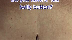 Do you have a slit or oval belly button? #learnontiktok #tiktokpartner #bellybutton #umbilicus