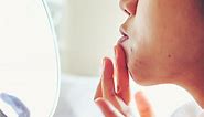 Which Acne Antibiotics Are Best for Breakouts?