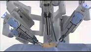 da Vinci® Surgery - How It Works