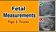 Fetal Measurements, Tips and Tricks