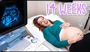 14 Week Pregnancy Ultrasound - Baby Moving and Yawning!