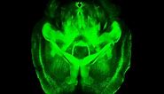 Technique to create transparent brains could transform neuroscience