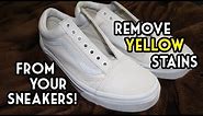 How To Remove Yellow Stains From Your Sneakers | The SIMPLEST and MOST EFFECTIVE Way