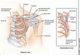 Pictures of Shoulder Nerve Damage