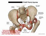 Pelvic Pain Si Joint