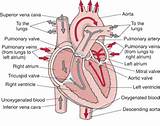 Symptoms Of Acute Myocardial Infarction