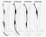 Nerve Regeneration In Legs