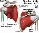 Images of Rotator Cuff Replacement