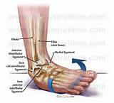 Injuries To The Foot Images